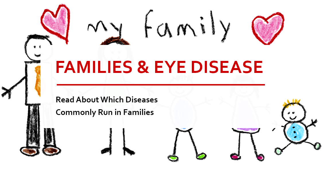 Which Eye Diseases Run In Families?
