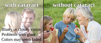 Learn how cataracts affect your vision