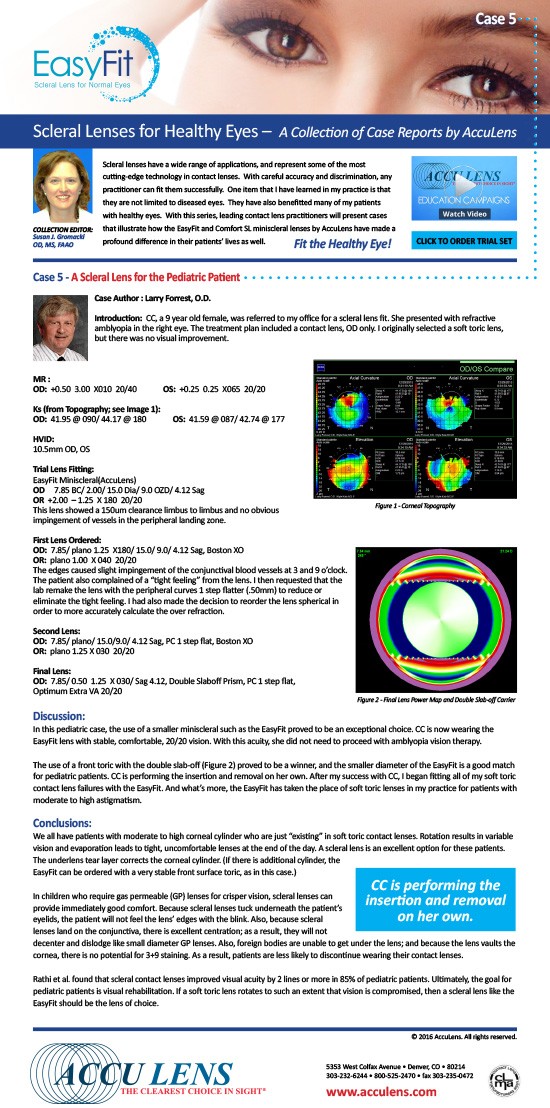 AccuLens Case Study #5
