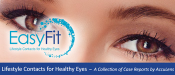 Scleral Lenses for Healthy Eyes Case #4