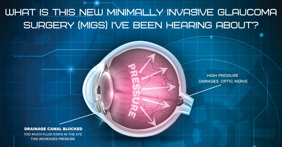 What is Minimally Invasive Glaucoma Surgery?