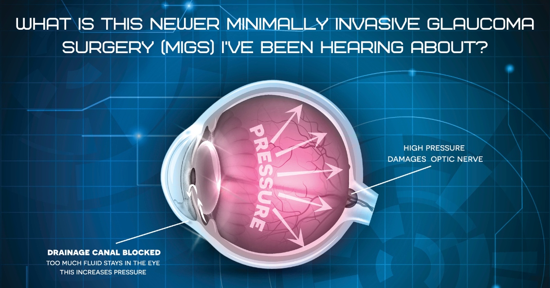 Minimally Invasive Glaucoma Surgery