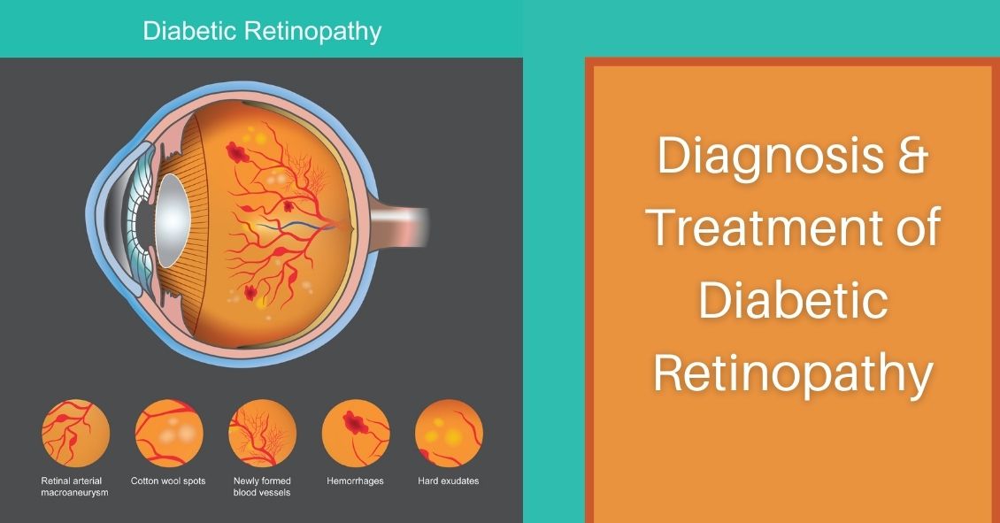 Diagnosis and Treatment of Diabetic Retinopathy