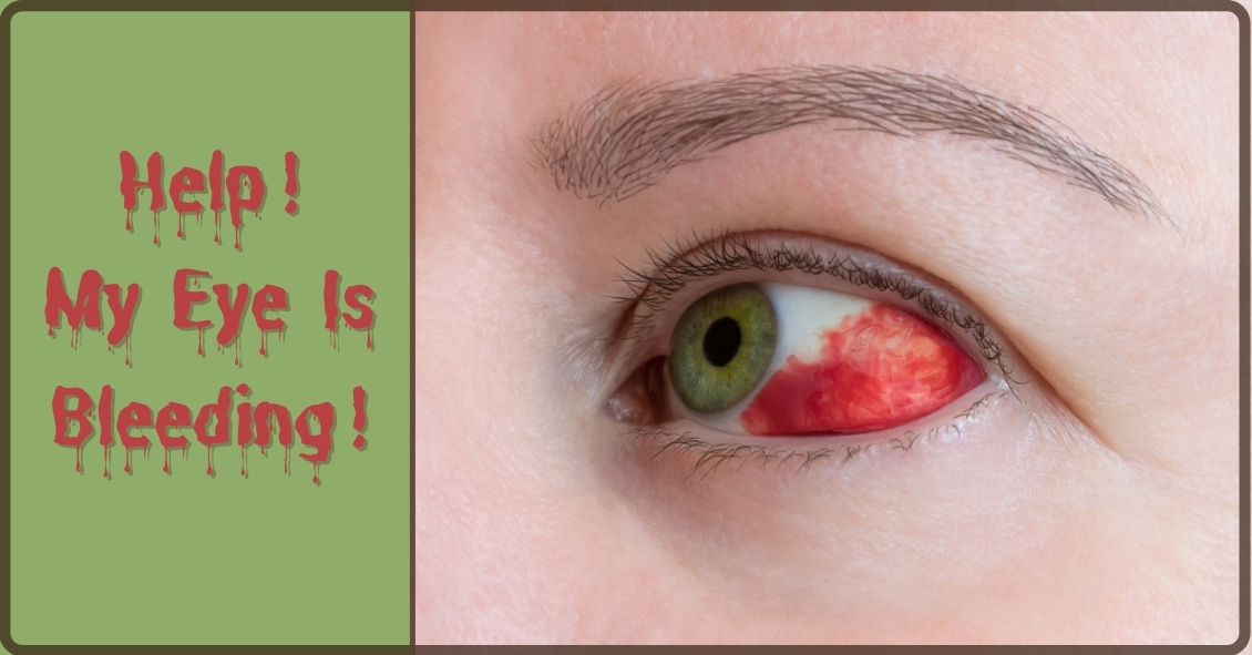 Help!  Is My Eye Bleeding?