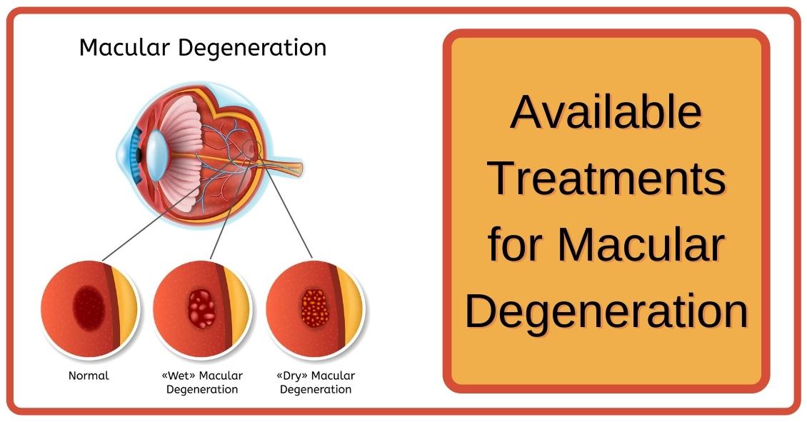 Dealing with Macular Degeneration