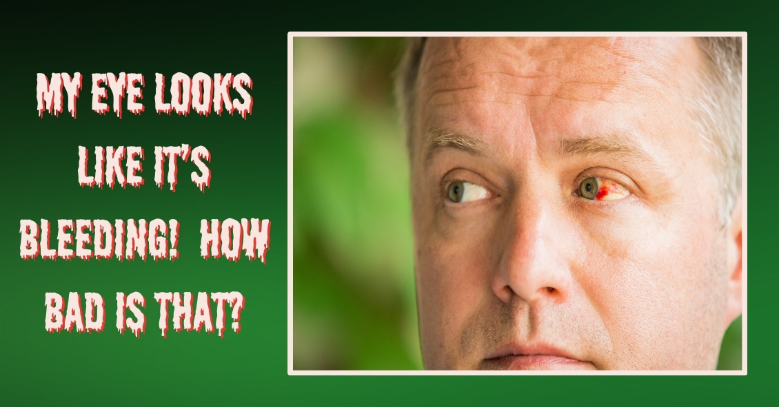 I Think My Eye Is Bleeding!