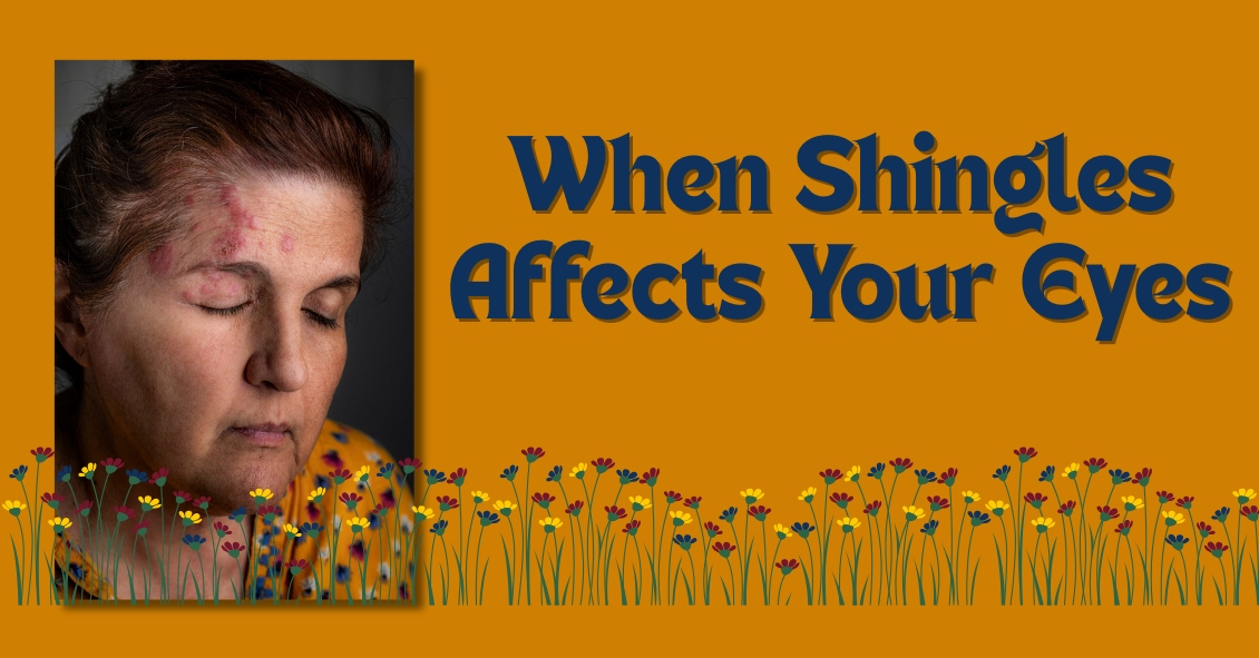 Your Eyes and Shingles