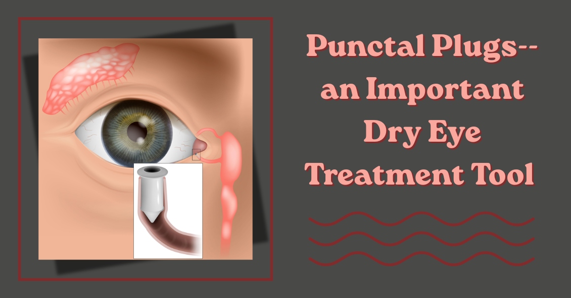 Punctal Plugs, a Dry Eye Treatment Tool