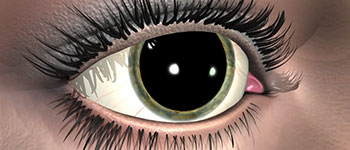 Example of Content: 5 Reasons to Dilate Your Eye